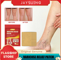PARCHES PARA VARICES