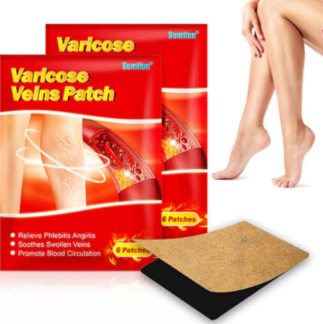 PARCHES PARA VARICES